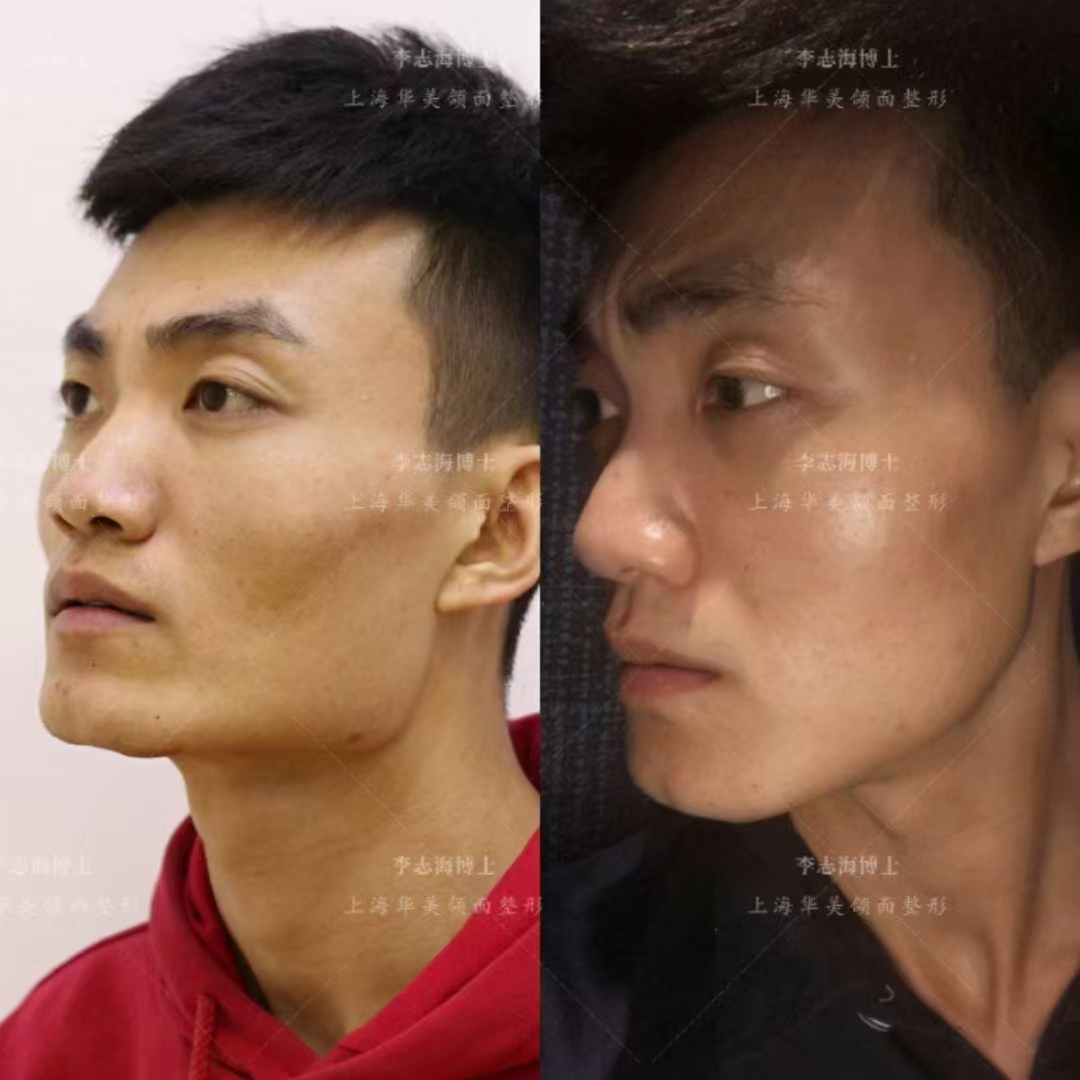 昆明艺星：学生党的美容福音