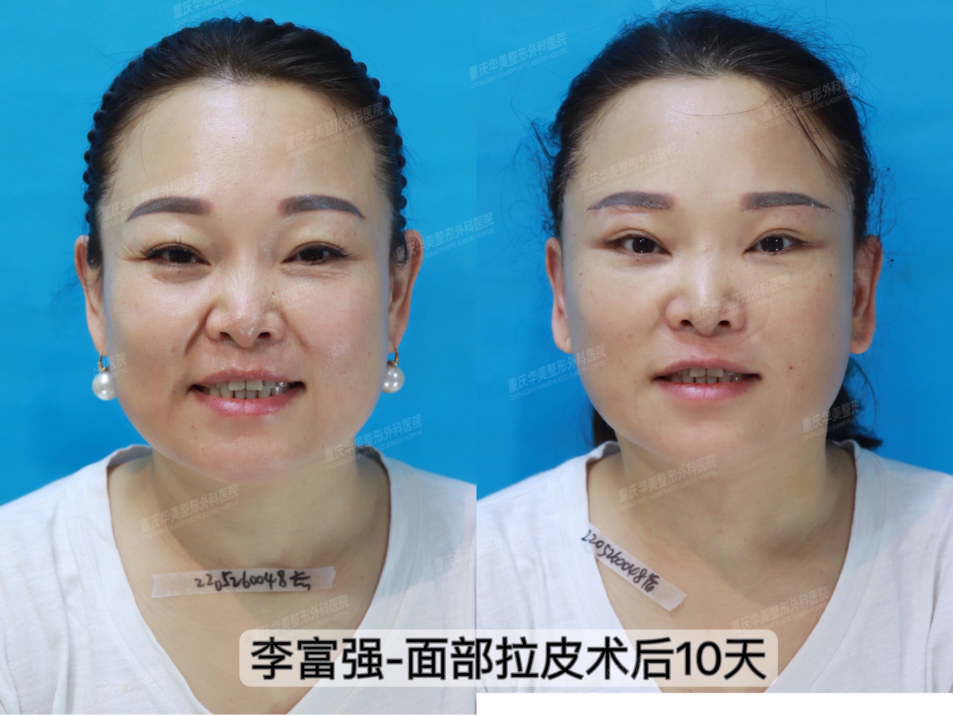 昆明铜雀台：抗衰界的扛把子