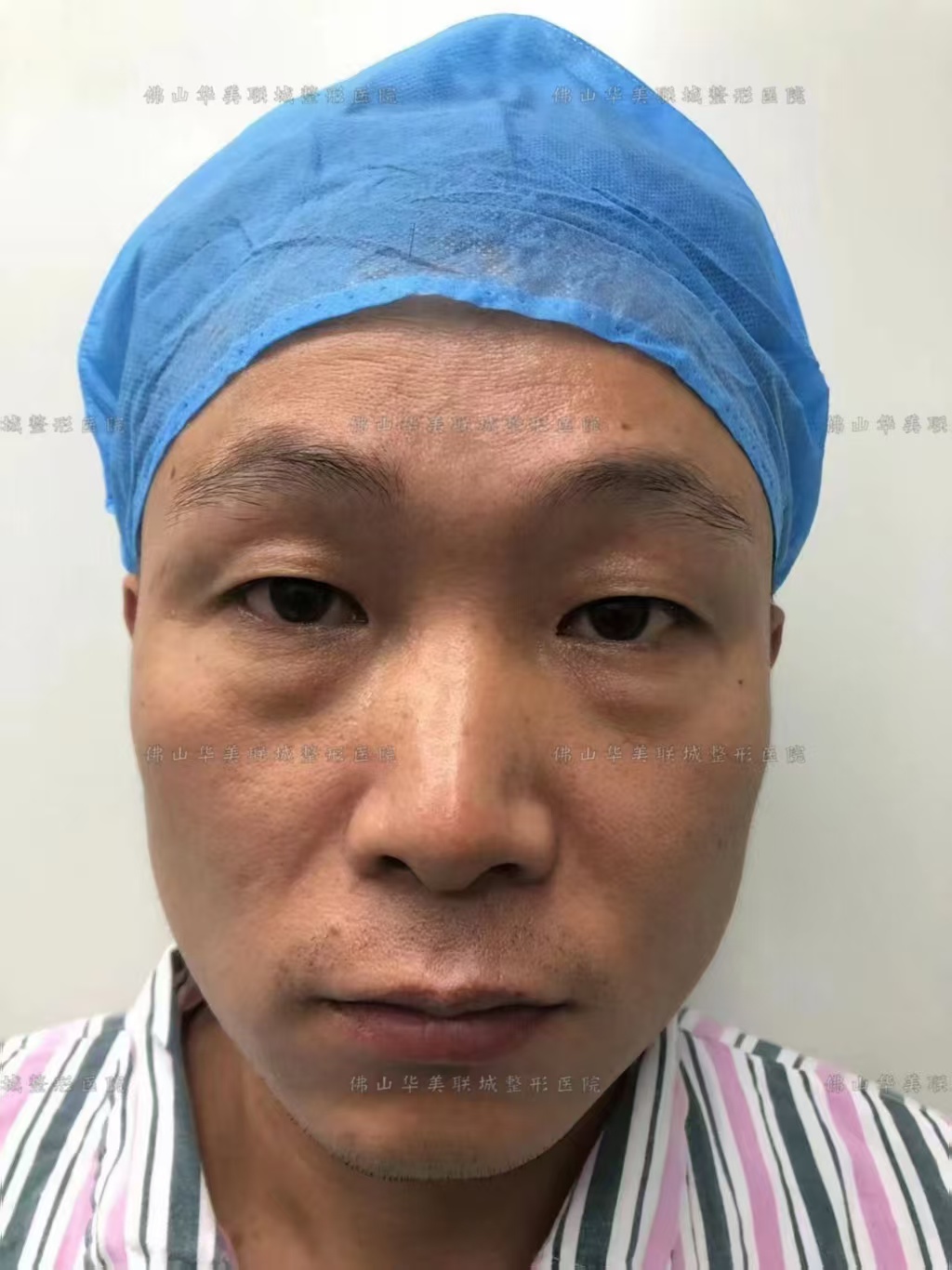 昆明韩辰：韩式美学的精致之选