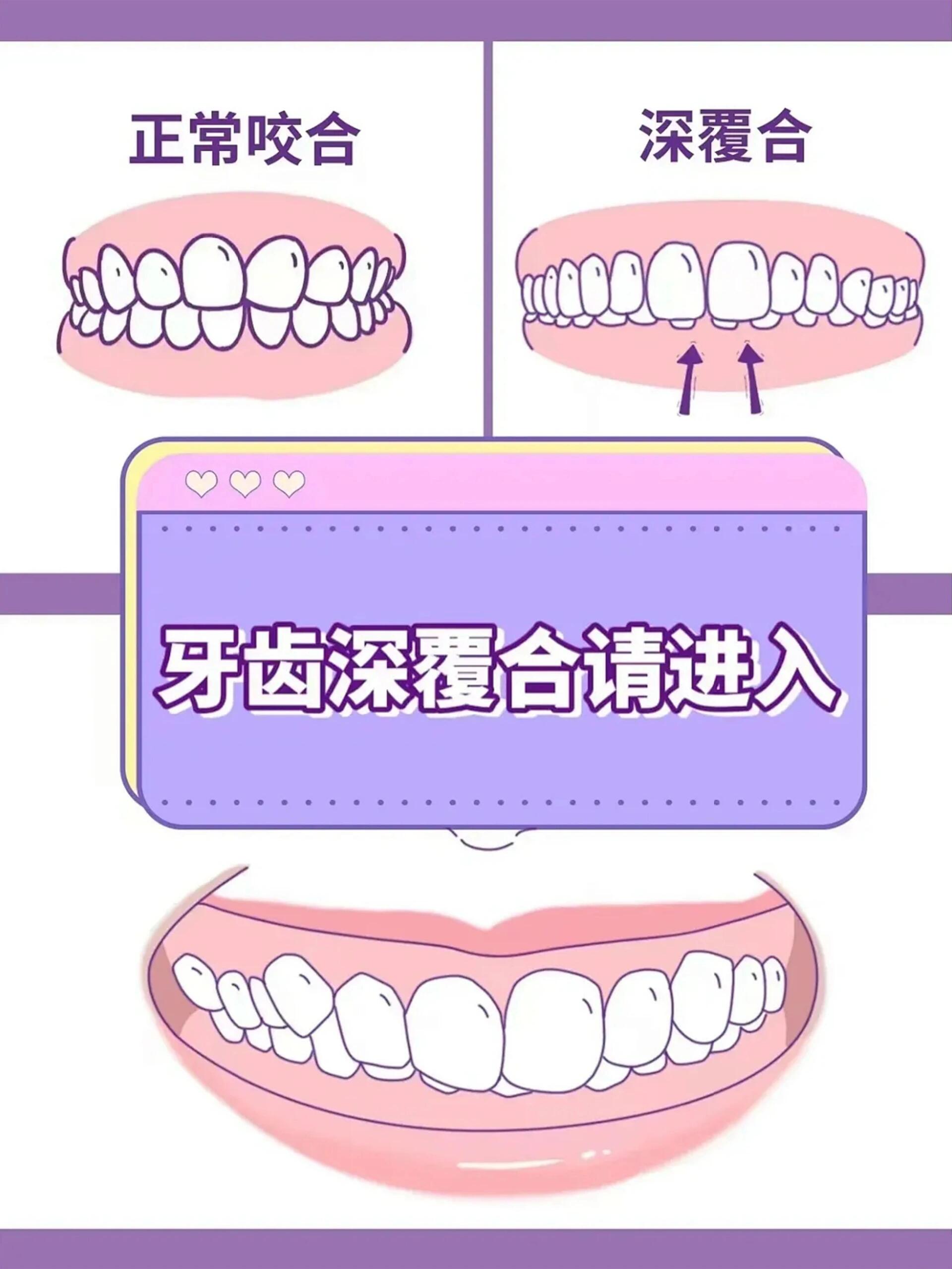 牙博士口腔即刻种植与修复方案www.8682.cc