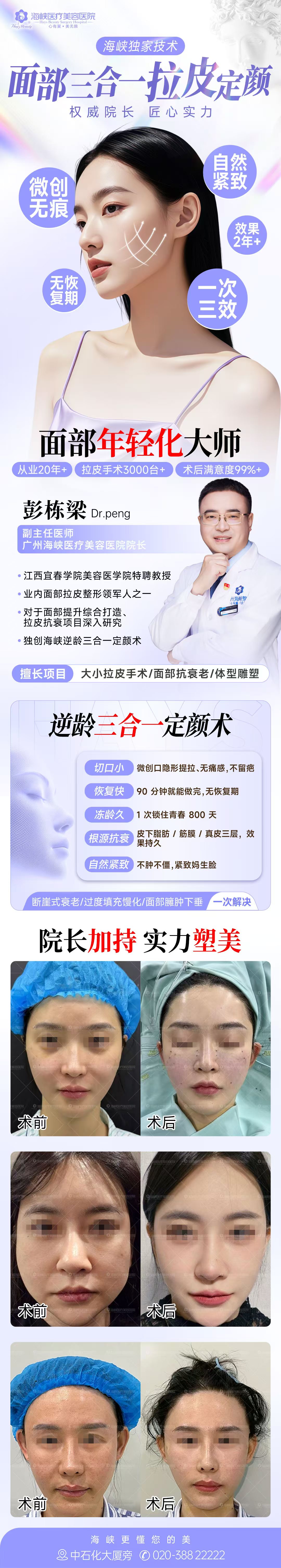 范榮杰醫(yī)生肋軟骨隆鼻優(yōu)勢(shì)