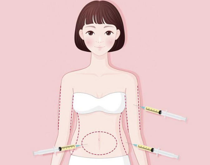 上海徐永丰用户评价真实吗？看10000+鼻修复/吸脂案例里的细节控真相