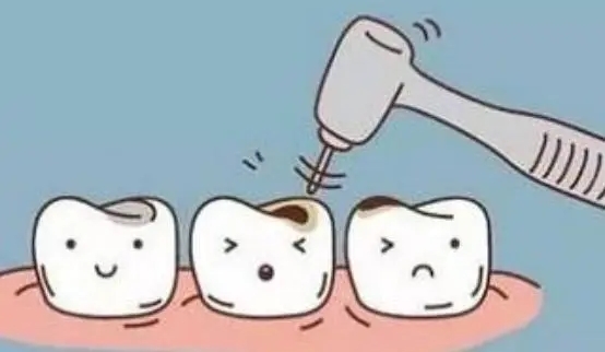 珠海中大五院口腔科：補牙收費與技術(shù)特色