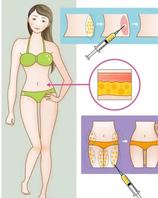 2025北京脂肪填充修复好的医院排名！纯脂/润美玉之光等10家是修复能手，面部+腿型填充都放心