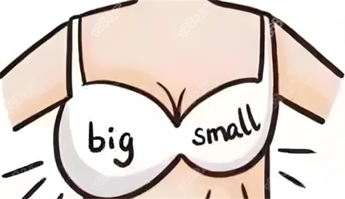 深圳做平胸手术哪家好？艺星内窥镜缩胸技术，小创口修养快，附口碑医生