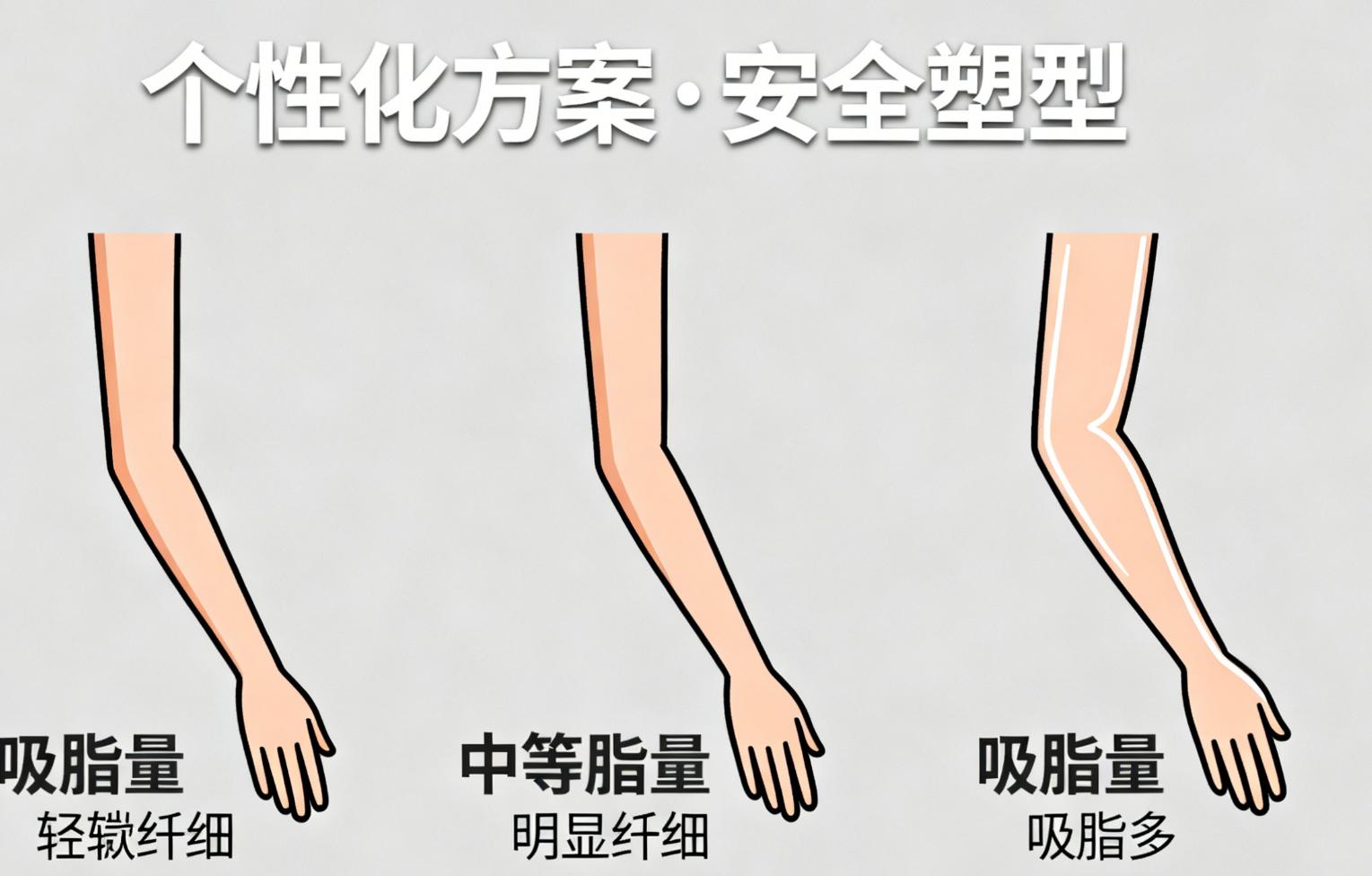 廣州壹加壹醫(yī)院及就診實用建議：讓成效更有確保