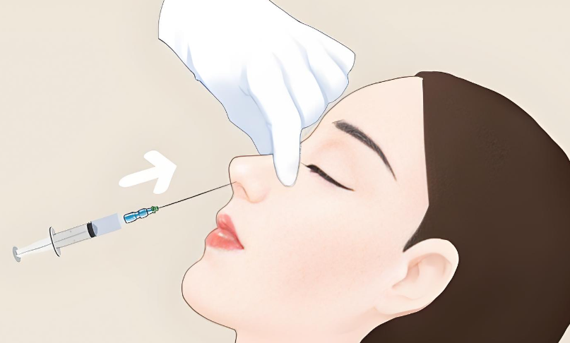 有在陳向東那里注射隆鼻的嗎