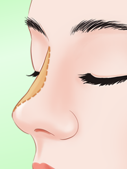 找對(duì)院！深圳福田區(qū)張輝鼻整形是什么醫(yī)院？鴻瑞/南華西晶（福田雙院），鼻修復(fù)68萬起