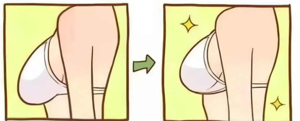 李建東維維提升手術(shù)是正規(guī)機構(gòu)