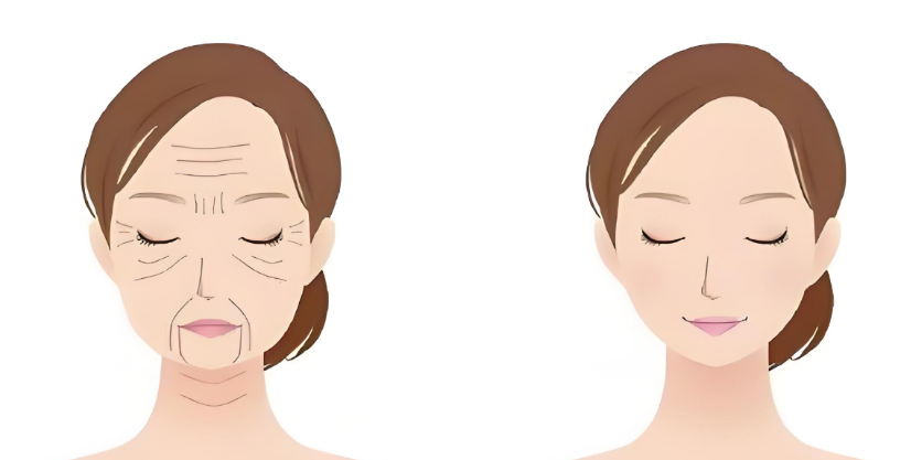 杭州幼態(tài)臉打造攻略之選擇建議