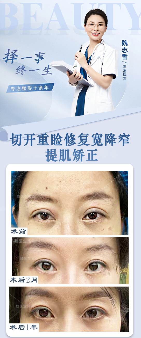 吳焱秋醫(yī)生在雙眼皮修復(fù)領(lǐng)域的影響力如何？