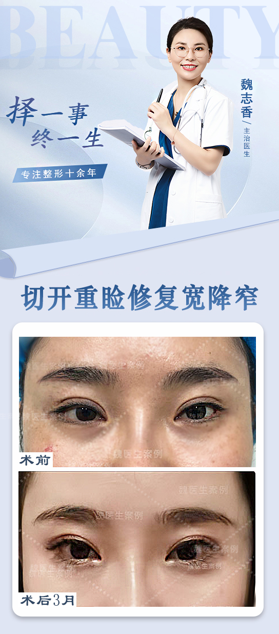 吳焱秋醫(yī)生的服務(wù)態(tài)度對(duì)口碑有何影響？