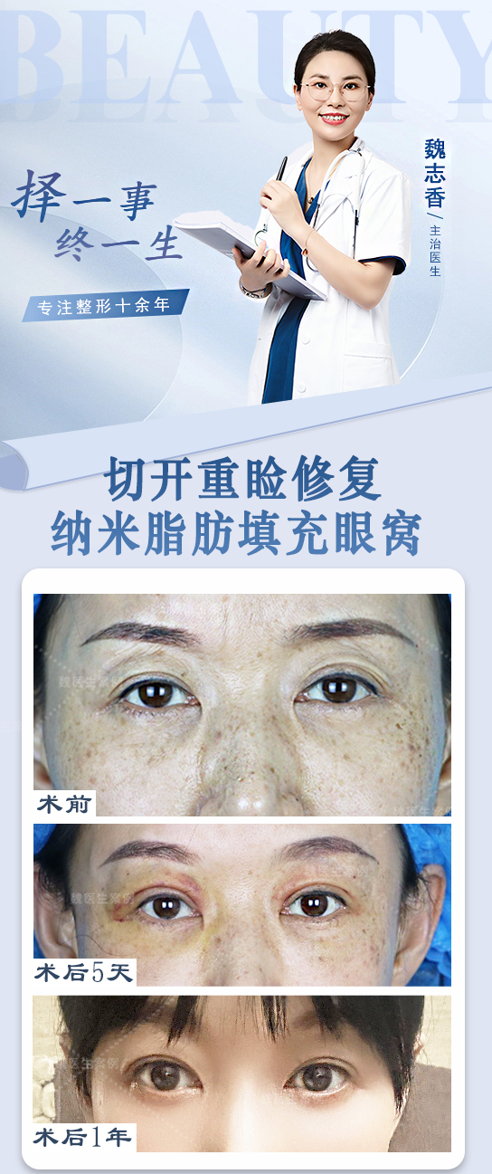 如何判斷吳焱秋雙眼皮修復(fù)是否適合自己？