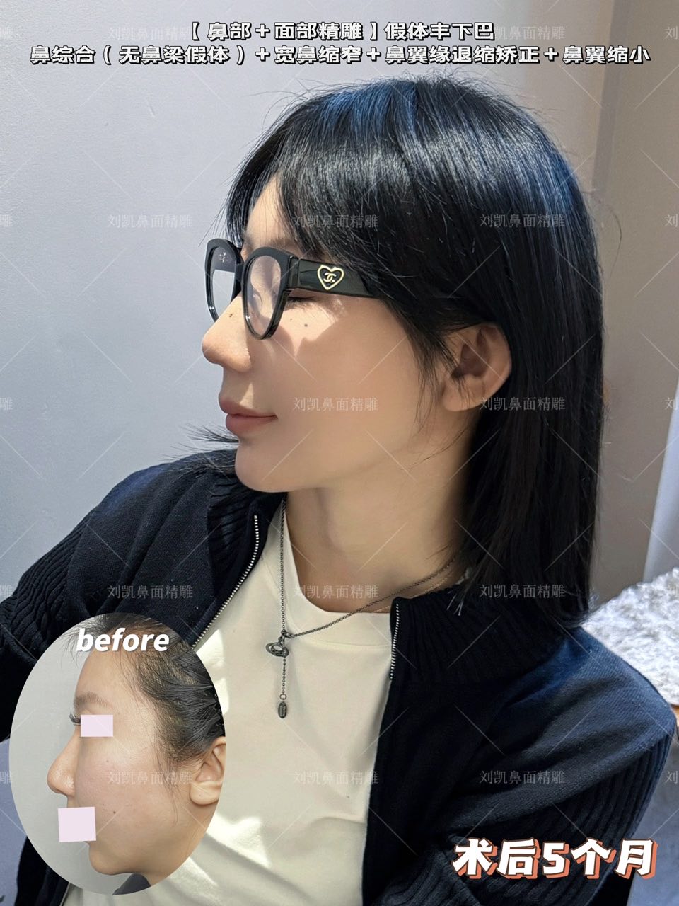 长沙中科皮肤病医院去疤痕怎么样？技术特色+价格3600起，口碑爆棚值得体验！