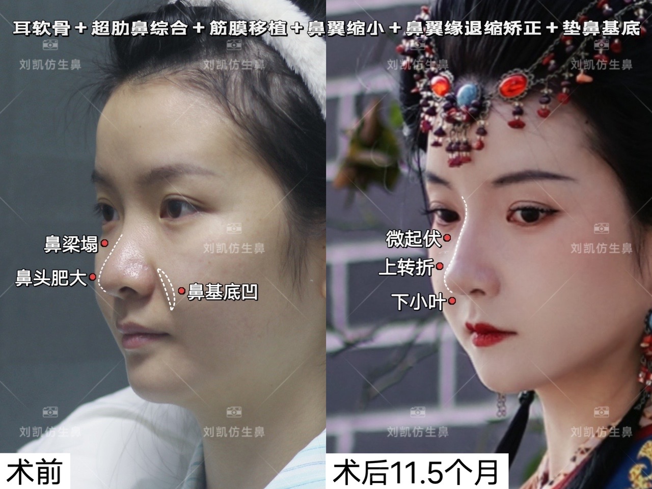 長(zhǎng)沙中科皮膚病醫(yī)院去疤痕價(jià)格貴嗎