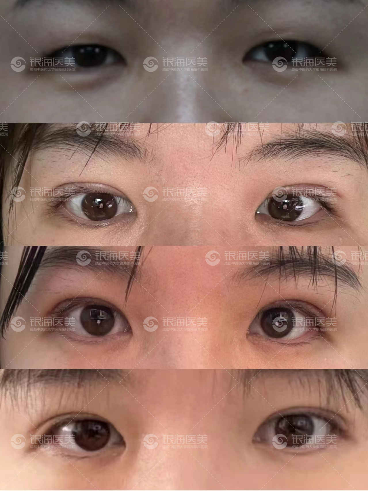 網(wǎng)選的【2026年國內(nèi)做后鞏膜加固術(shù)好的醫(yī)生排名】——褚仁遠(yuǎn)醫(yī)生