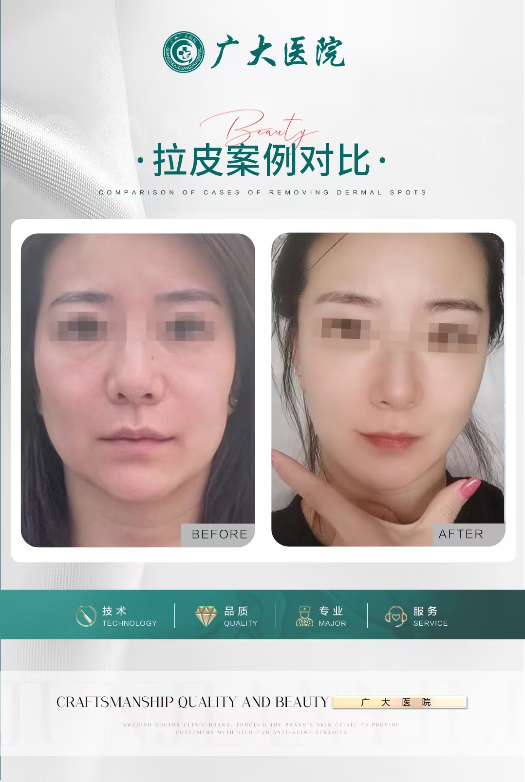 三、北京米蘭柏羽麗都醫(yī)療美容醫(yī)院是渠道醫(yī)院嗎？從多方面來判斷