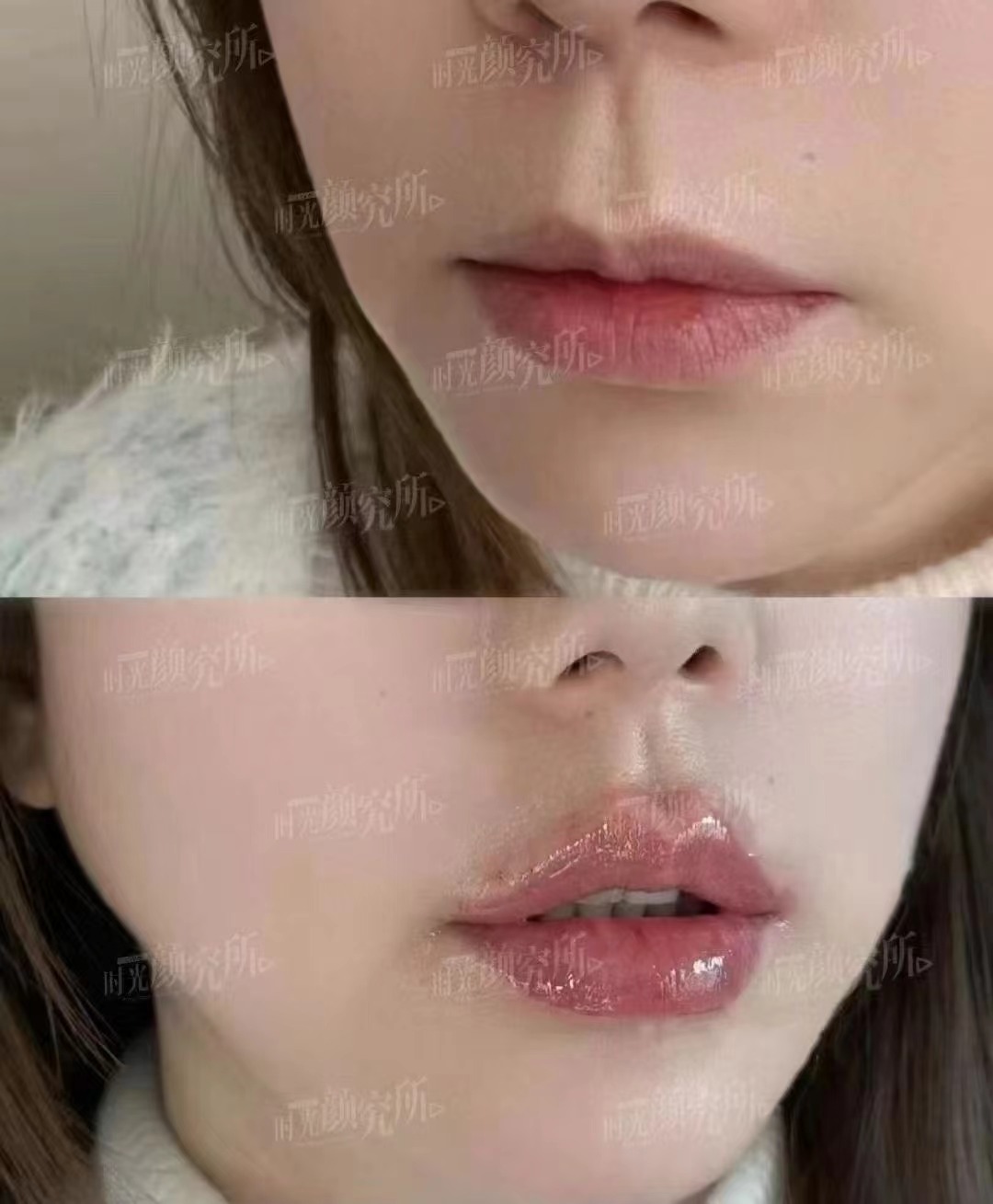 杜園園醫(yī)生預(yù)約方式攻略