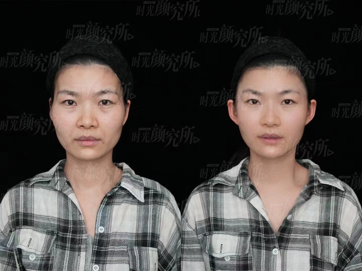 杜園園醫(yī)生患者真實(shí)反饋