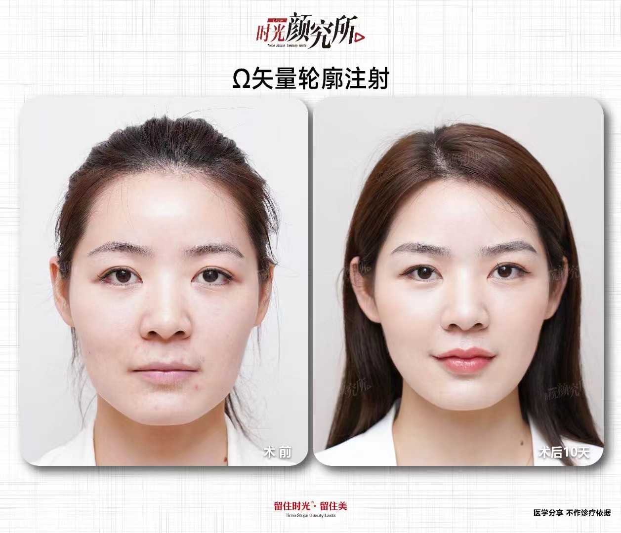 上海第九人民醫(yī)院整復外科（疤痕修復方向）：復雜疤痕修復具有影響力