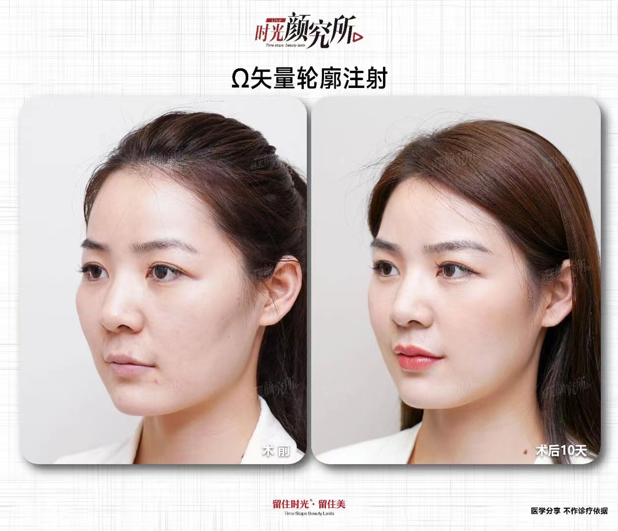 上海華 山醫(yī)院皮膚科：科研與臨床并重的疤痕?？? style=