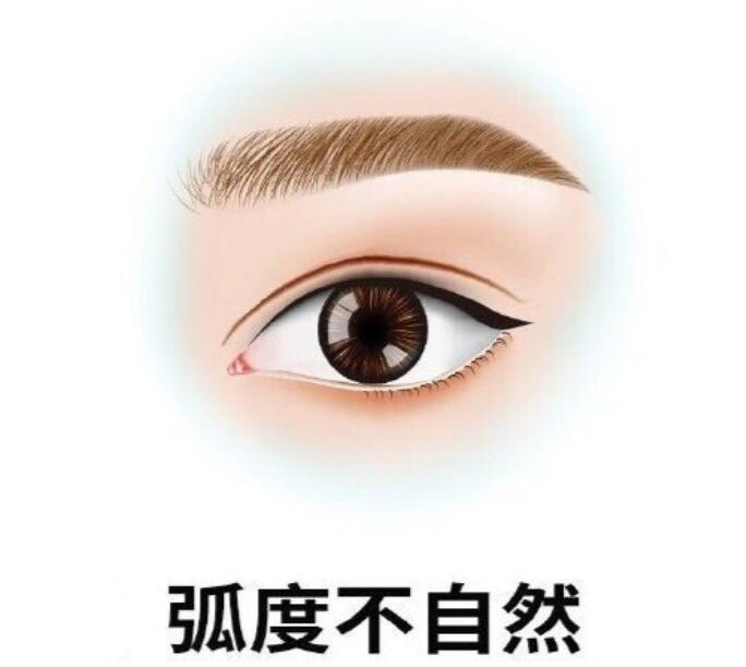 廣州張偉雙眼皮價(jià)格表