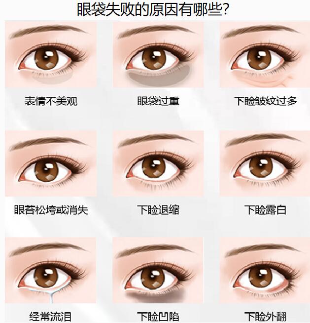 上海高冠云整形醫(yī)生在哪家醫(yī)院坐診