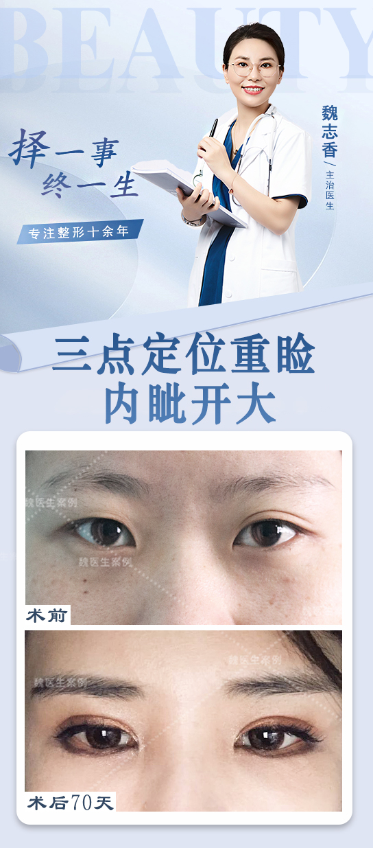 二、昆明典雅閣雙眼皮手術(shù)技術(shù)優(yōu)勢