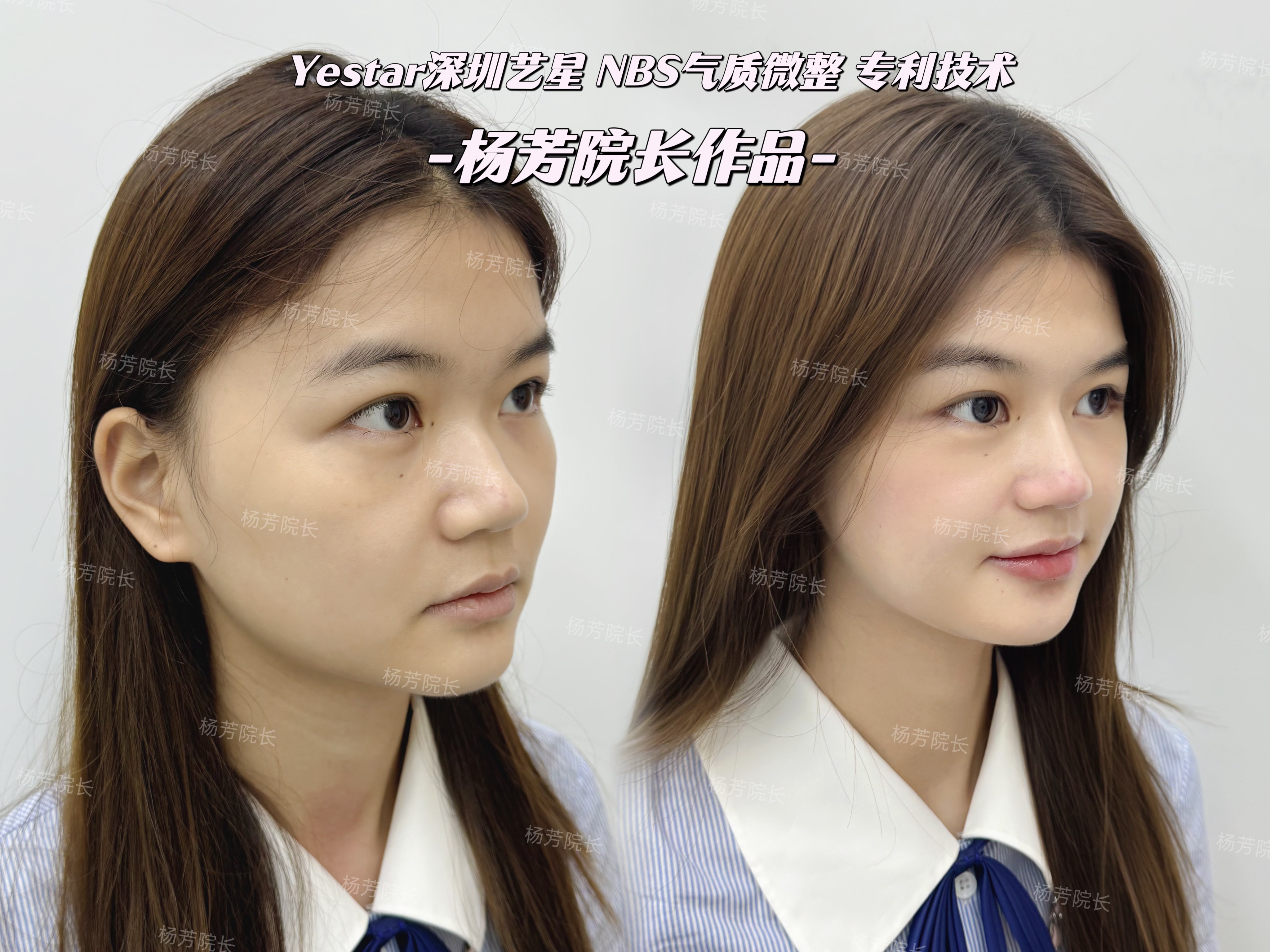 五、昆明典雅閣在雙眼皮修復(fù)領(lǐng)域的地位