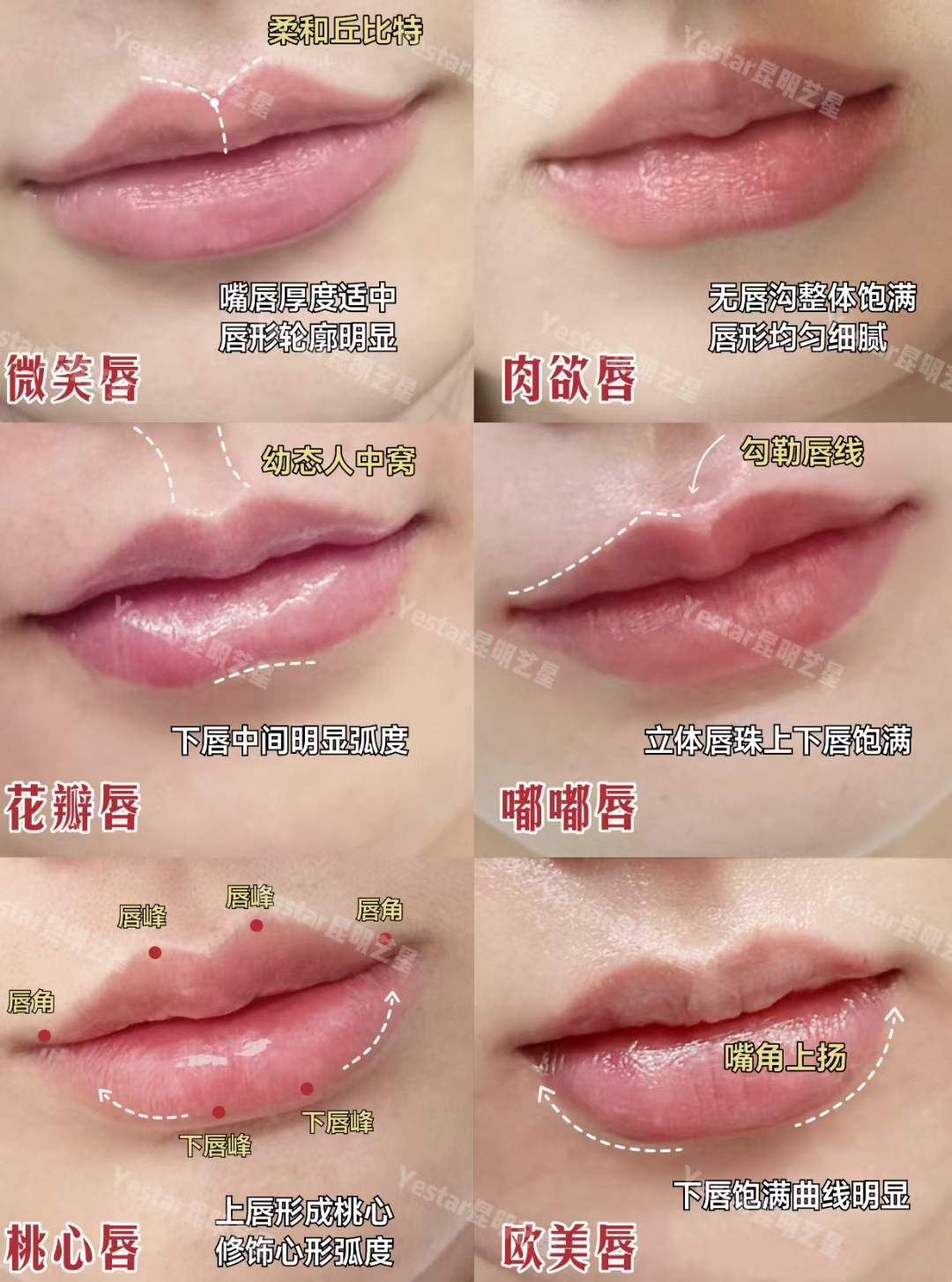 昆明典雅閣做雙眼皮術(shù)多少錢之與其他機構(gòu)對比