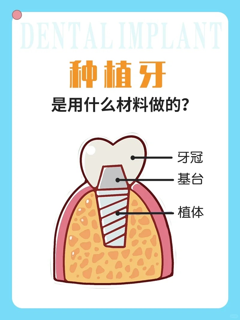 三、蘭州海濤口腔種植牙的真實(shí)實(shí)例