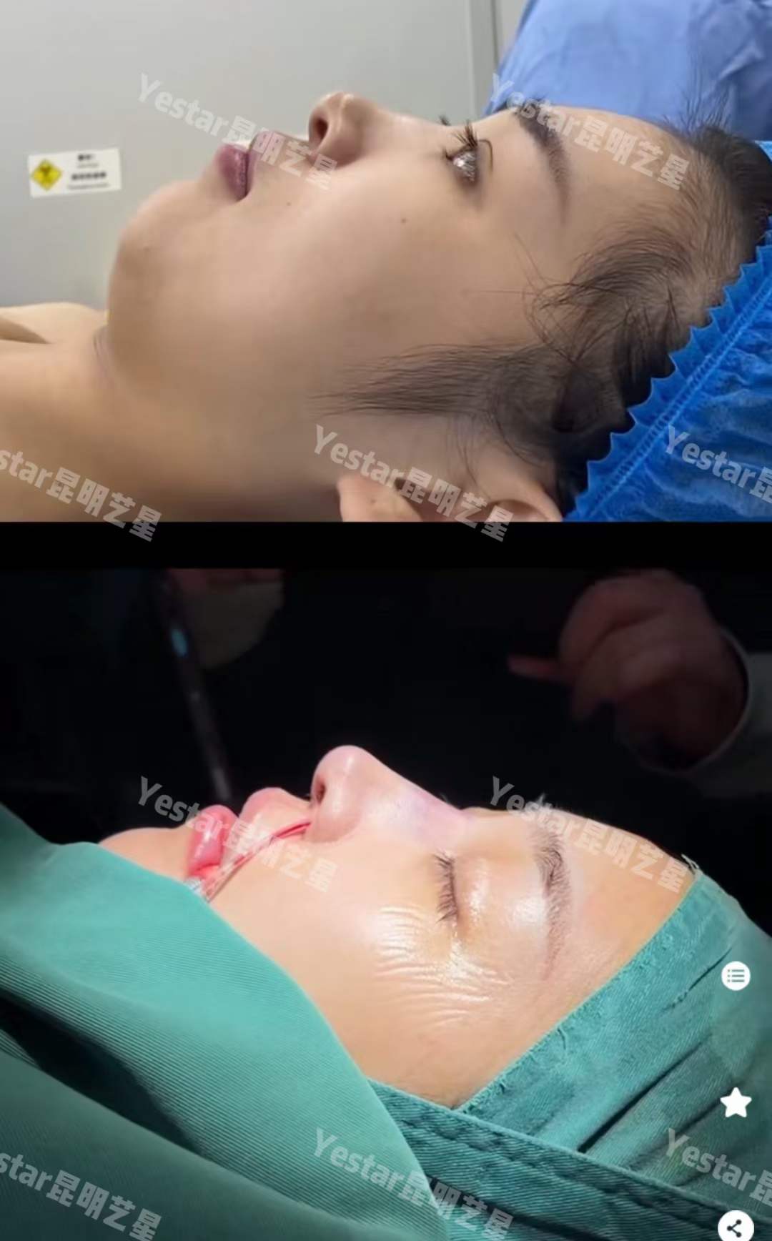 廣州藝星鄧晟華醫(yī)生個(gè)人簡(jiǎn)介——廣州藝星醫(yī)療美容醫(yī)院之整友反饋