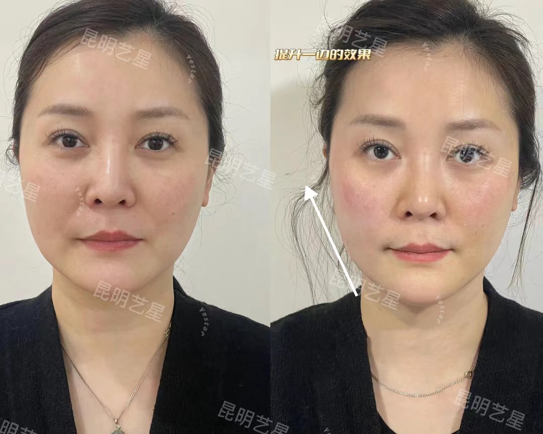 廣州藝星鄧晟華醫(yī)生個(gè)人簡(jiǎn)介——廣州藝星醫(yī)療美容醫(yī)院之價(jià)格收費(fèi)