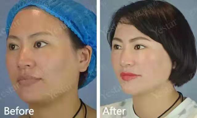 廣州藝星鄧晟華醫(yī)生個(gè)人簡(jiǎn)介——廣州藝星醫(yī)療美容醫(yī)院之口腔科特色