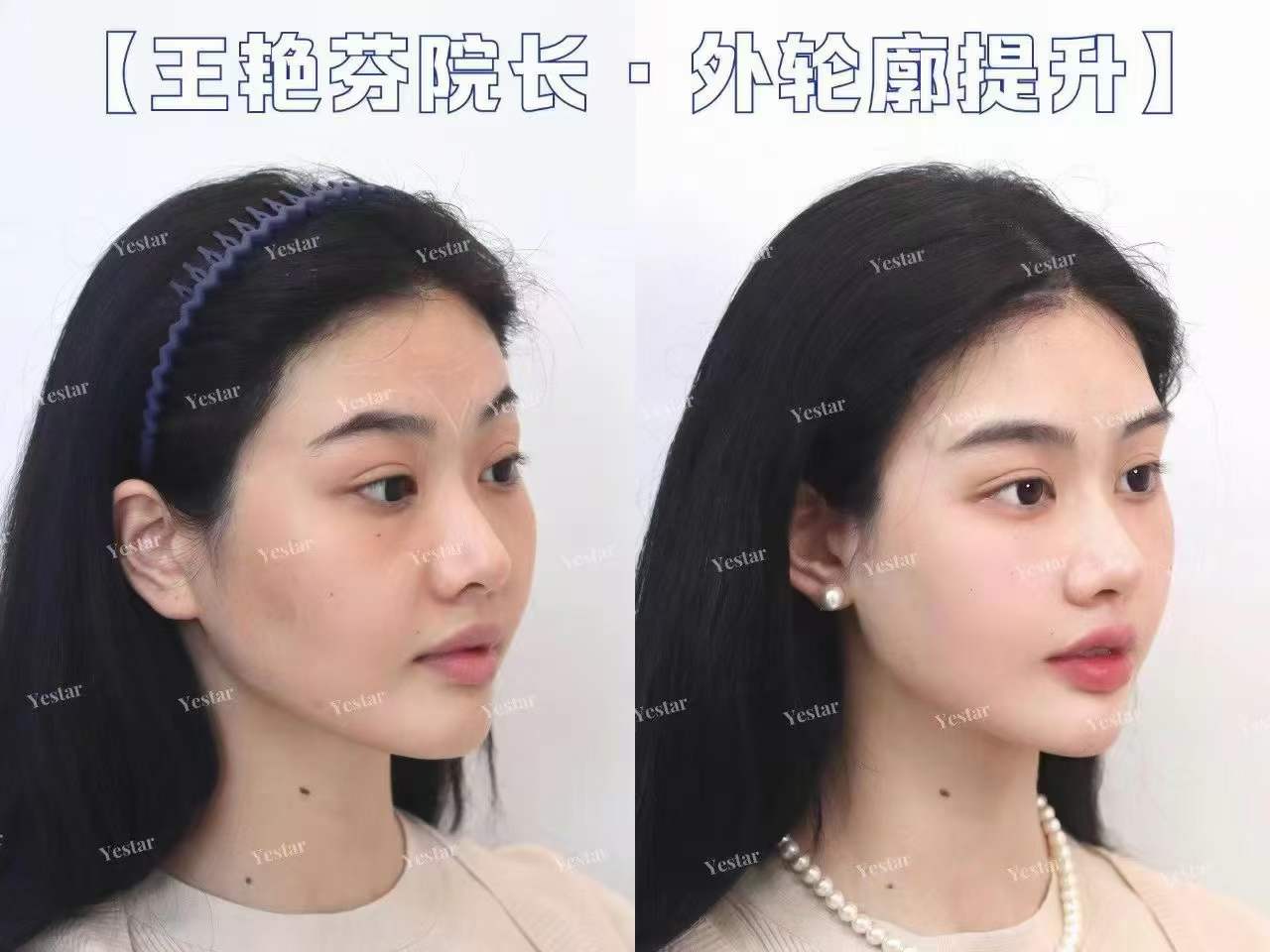 廣州藝星鄧晟華醫(yī)生個(gè)人簡(jiǎn)介——廣州藝星醫(yī)療美容醫(yī)院之預(yù)約方式