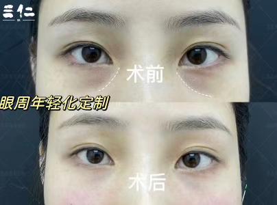 北京協(xié)和醫(yī)院：歷史悠久，疑難白內(nèi)障會(huì)診中 心