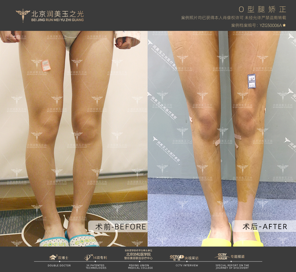 解放軍總醫(yī)院（301醫(yī)院）：實(shí)力強(qiáng)勁，復(fù)雜白內(nèi)障救治先鋒