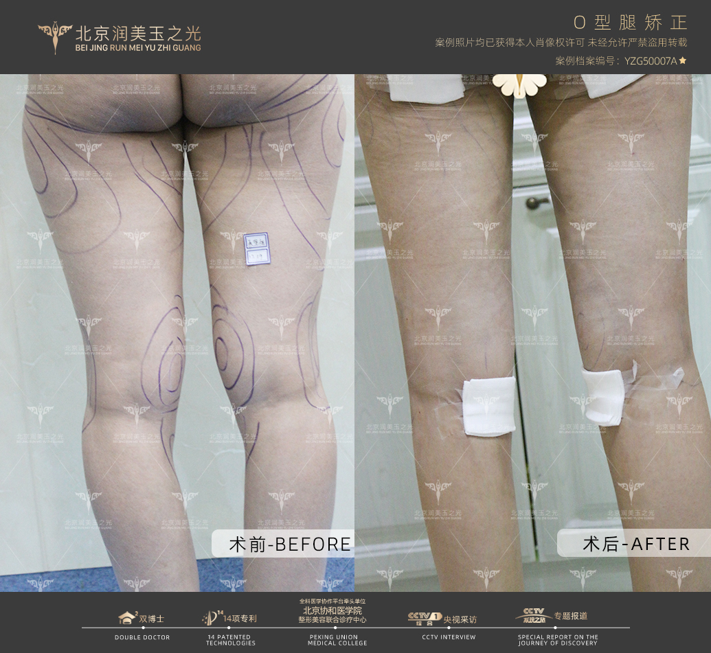 北京首大眼耳鼻喉醫(yī)院：特色優(yōu)勢(shì)，全方面服務(wù)白內(nèi)障患者