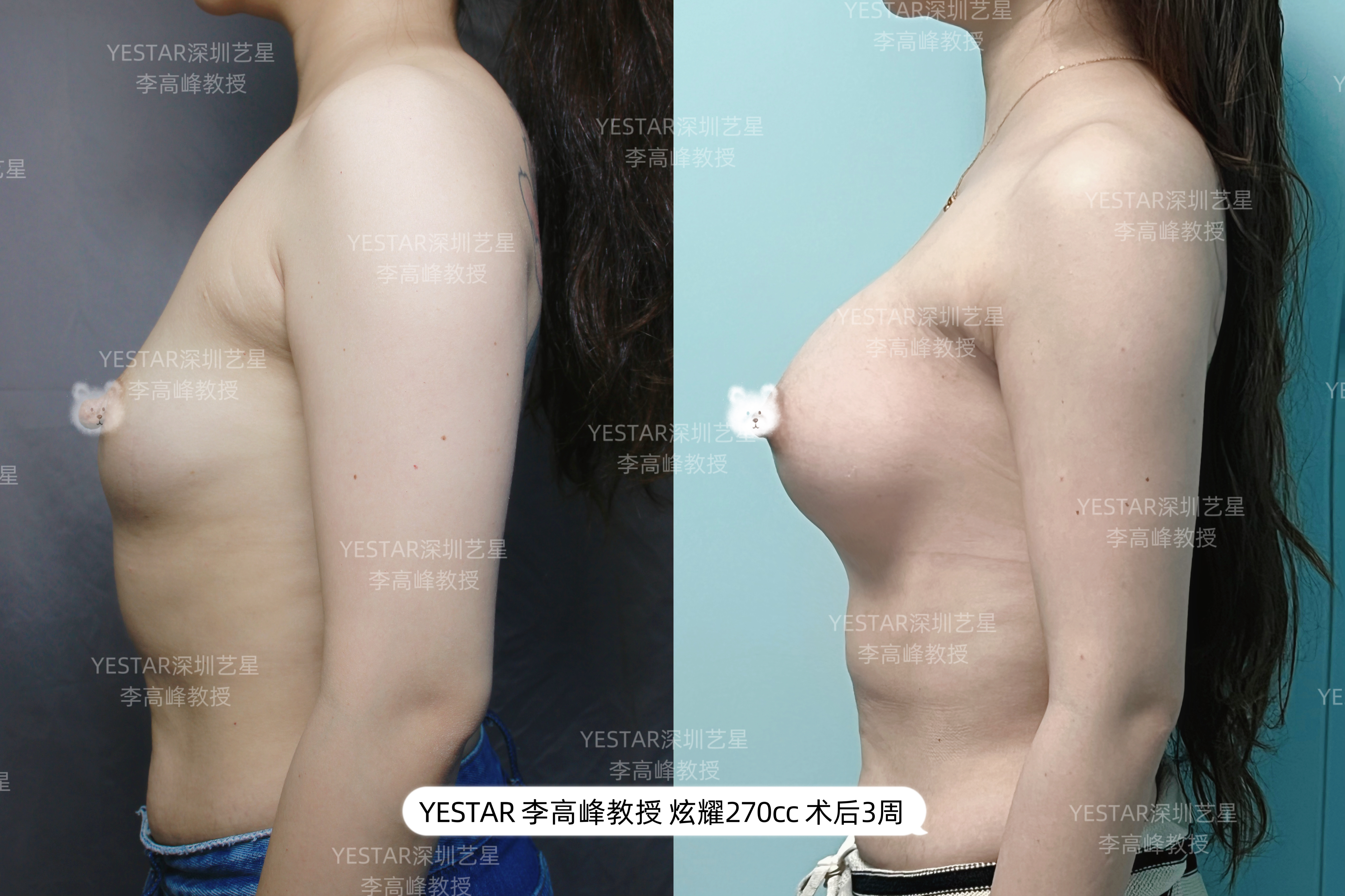 杭州这5家医院数位医生做黄金微雕做的好，3900元起塑形紧肤两不误，艺星薇琳上榜