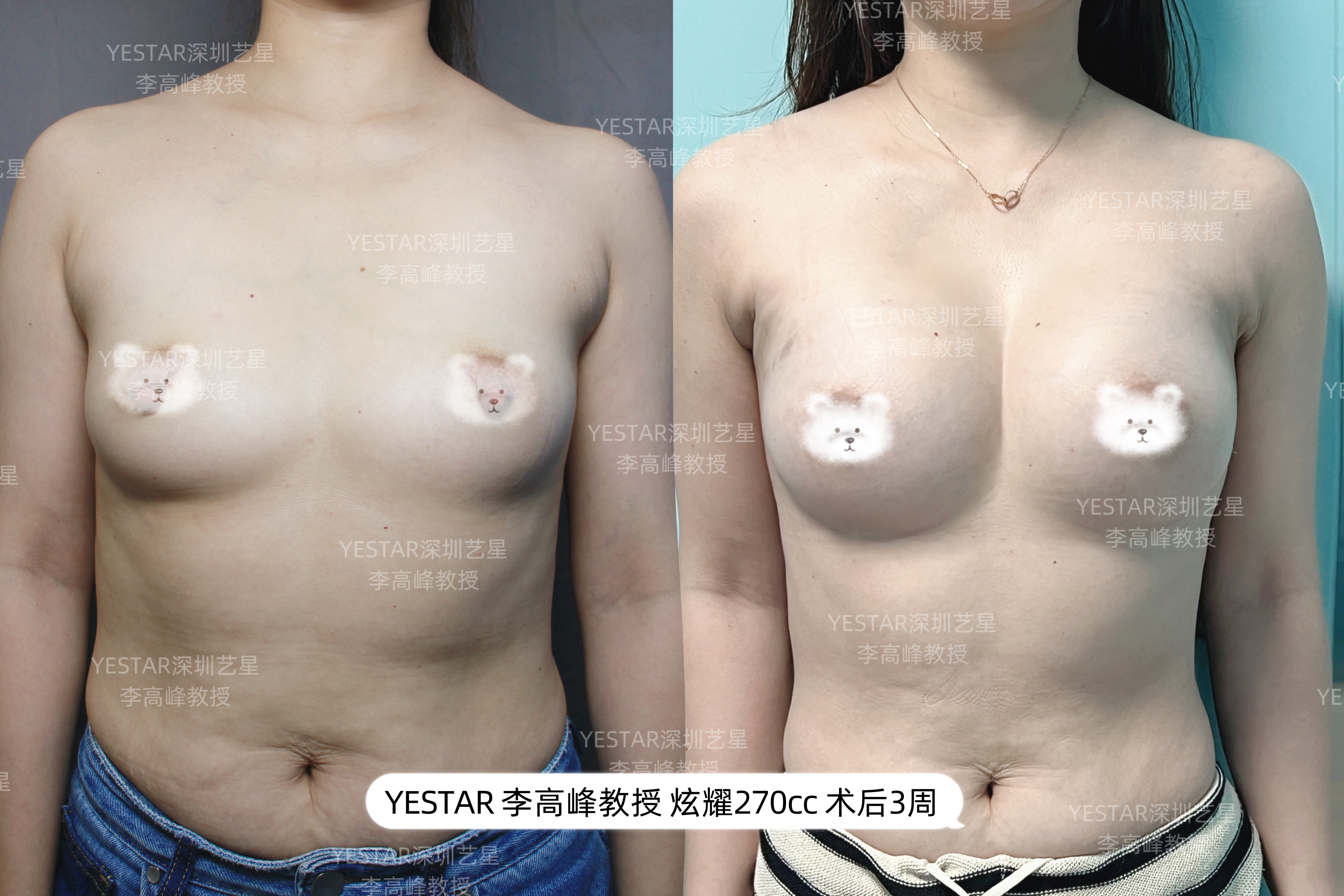 杭州這5家醫(yī)院數(shù)位醫(yī)生做黃金微雕做的好——杭州薇琳醫(yī)療美容