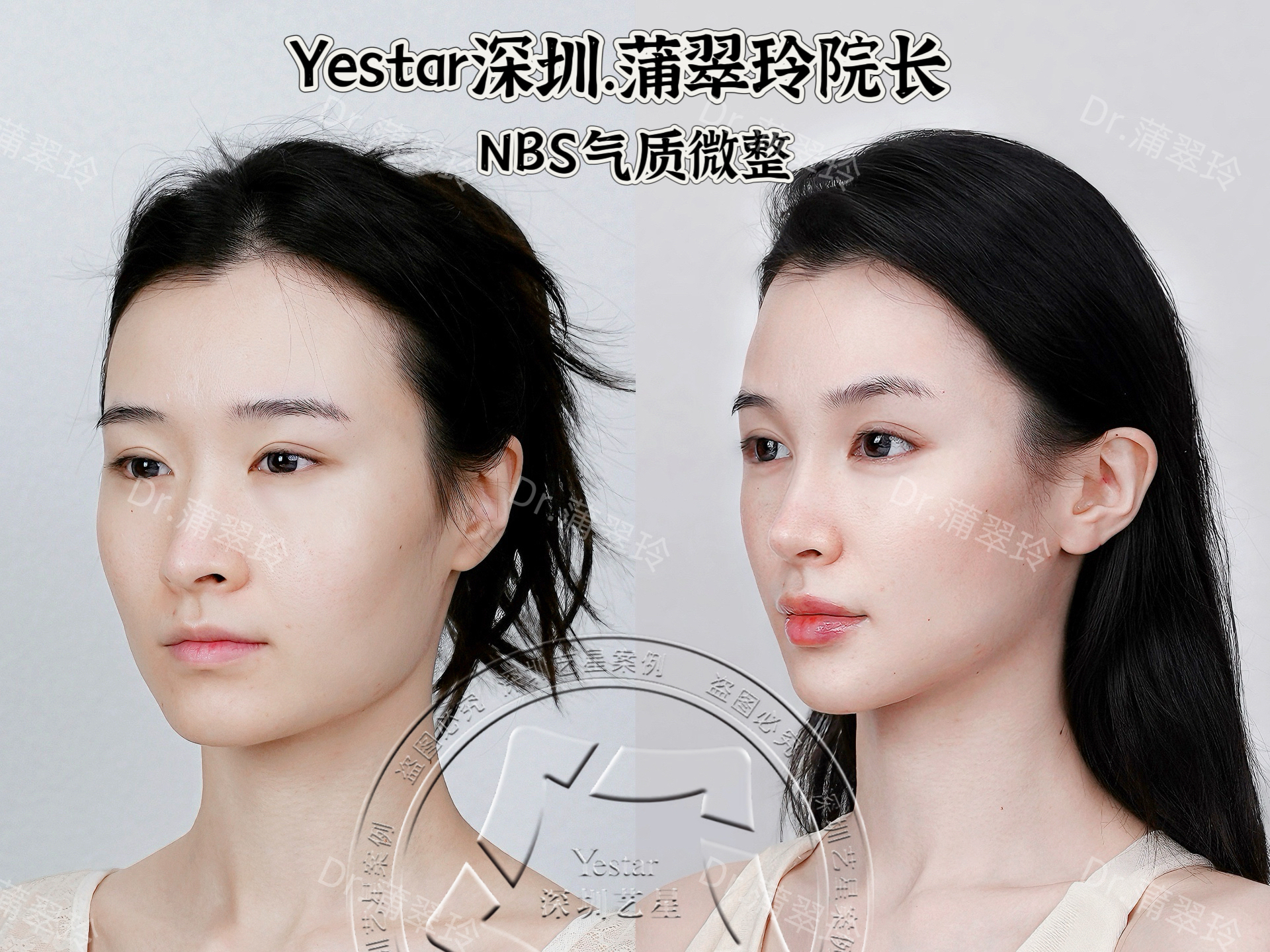 杭州這5家醫(yī)院數(shù)位醫(yī)生做黃金微雕做的好——杭州格萊美醫(yī)療美容