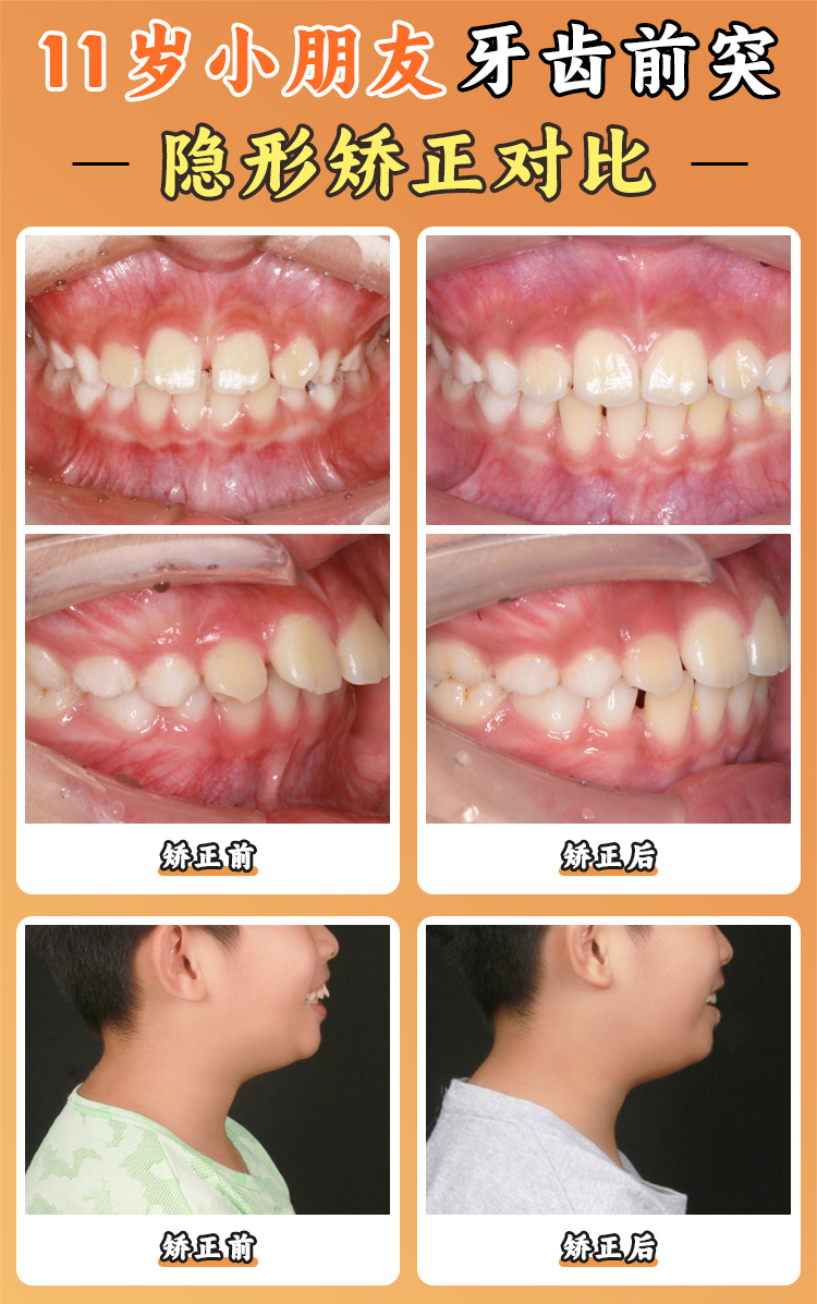 上海長海醫(yī)院口腔科朱強醫(yī)生的口碑如何？