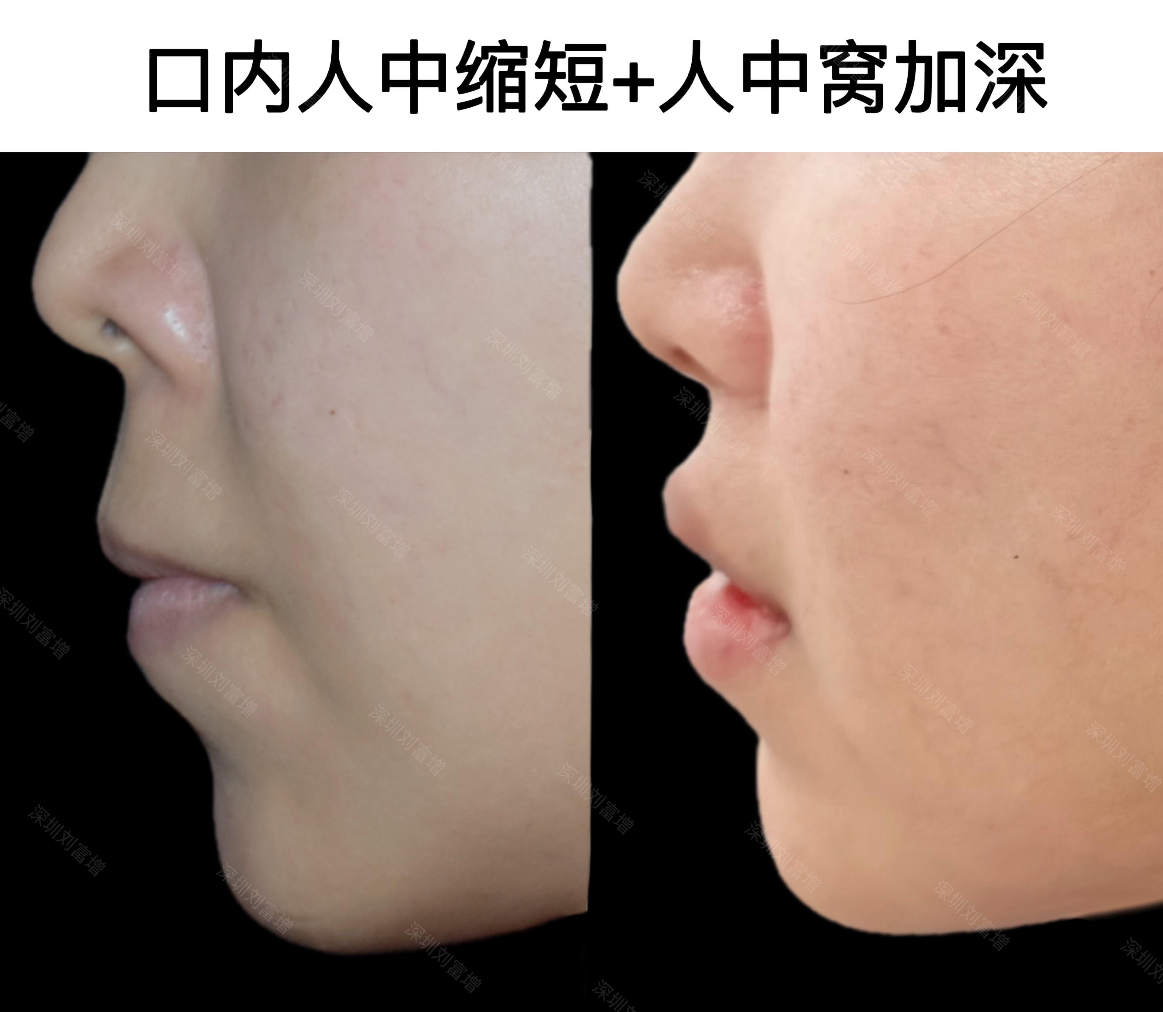 五、與其他醫(yī)生對(duì)比