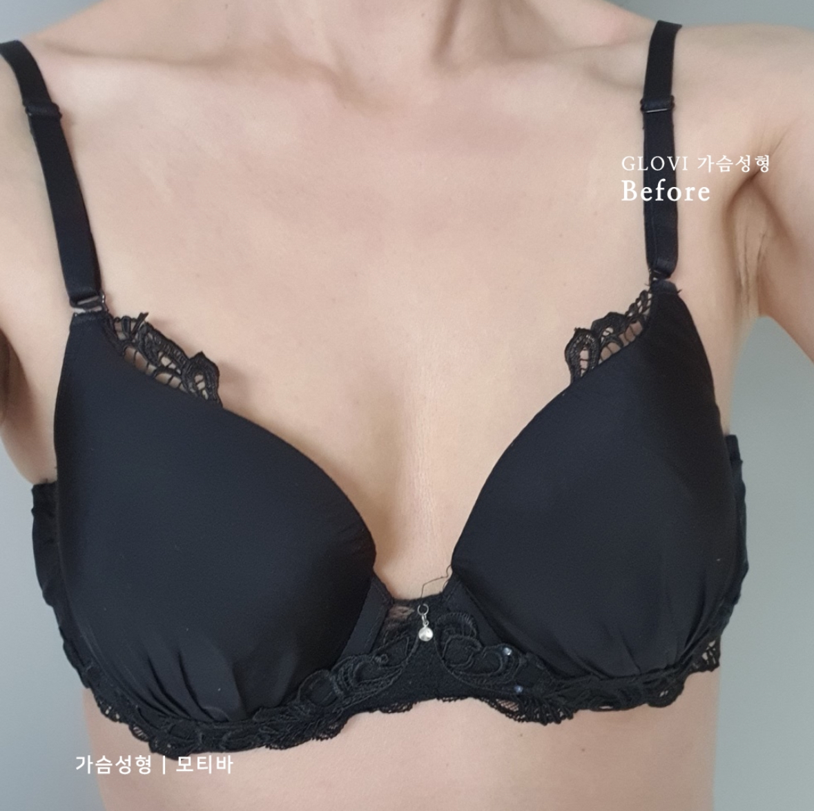 泉州海峽醫(yī)療美容醫(yī)院：專精塑美勝地