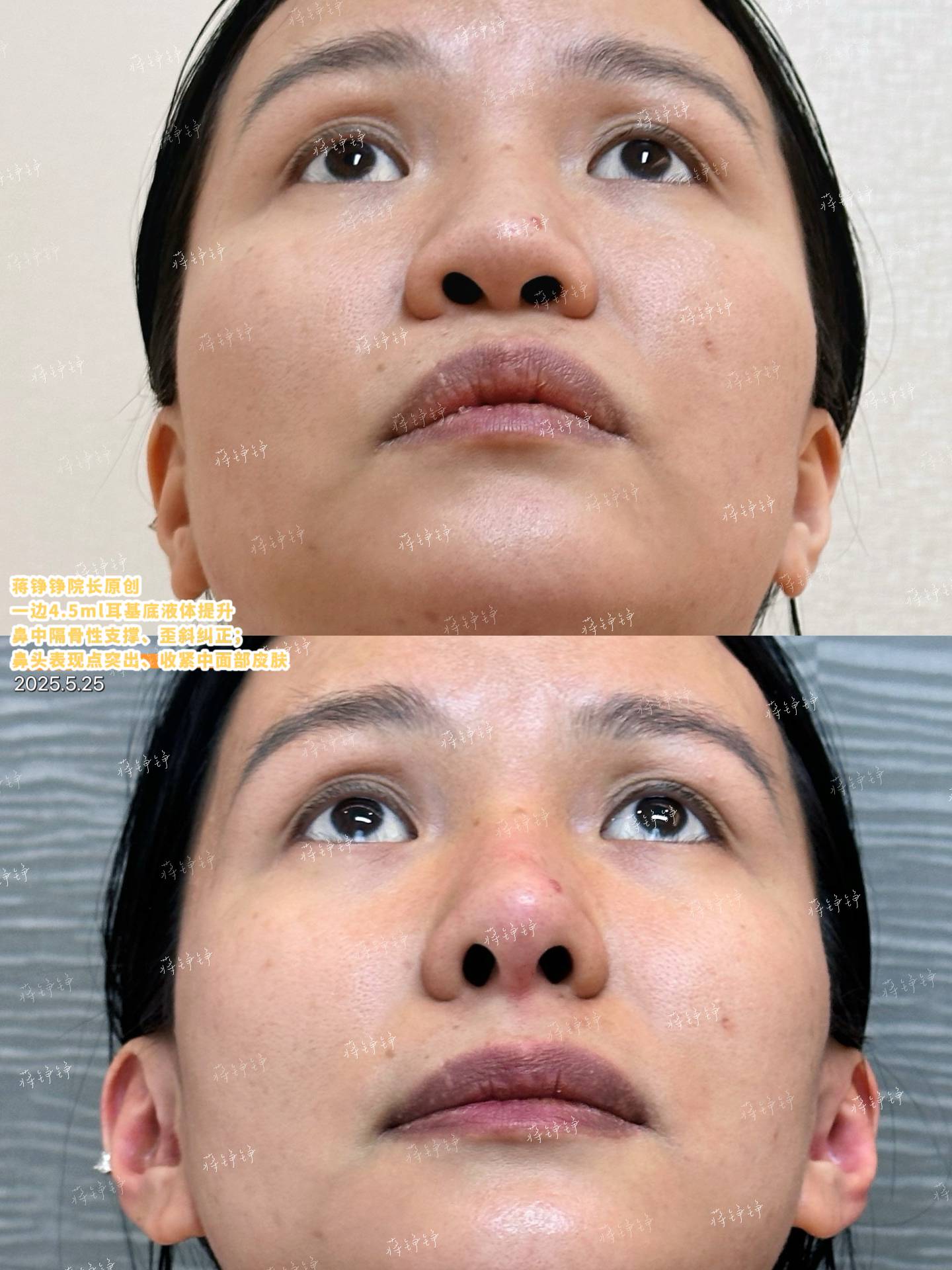 沈曄醫(yī)生做近視手術(shù)怎么樣：技術(shù)不錯(cuò)，患者點(diǎn)贊