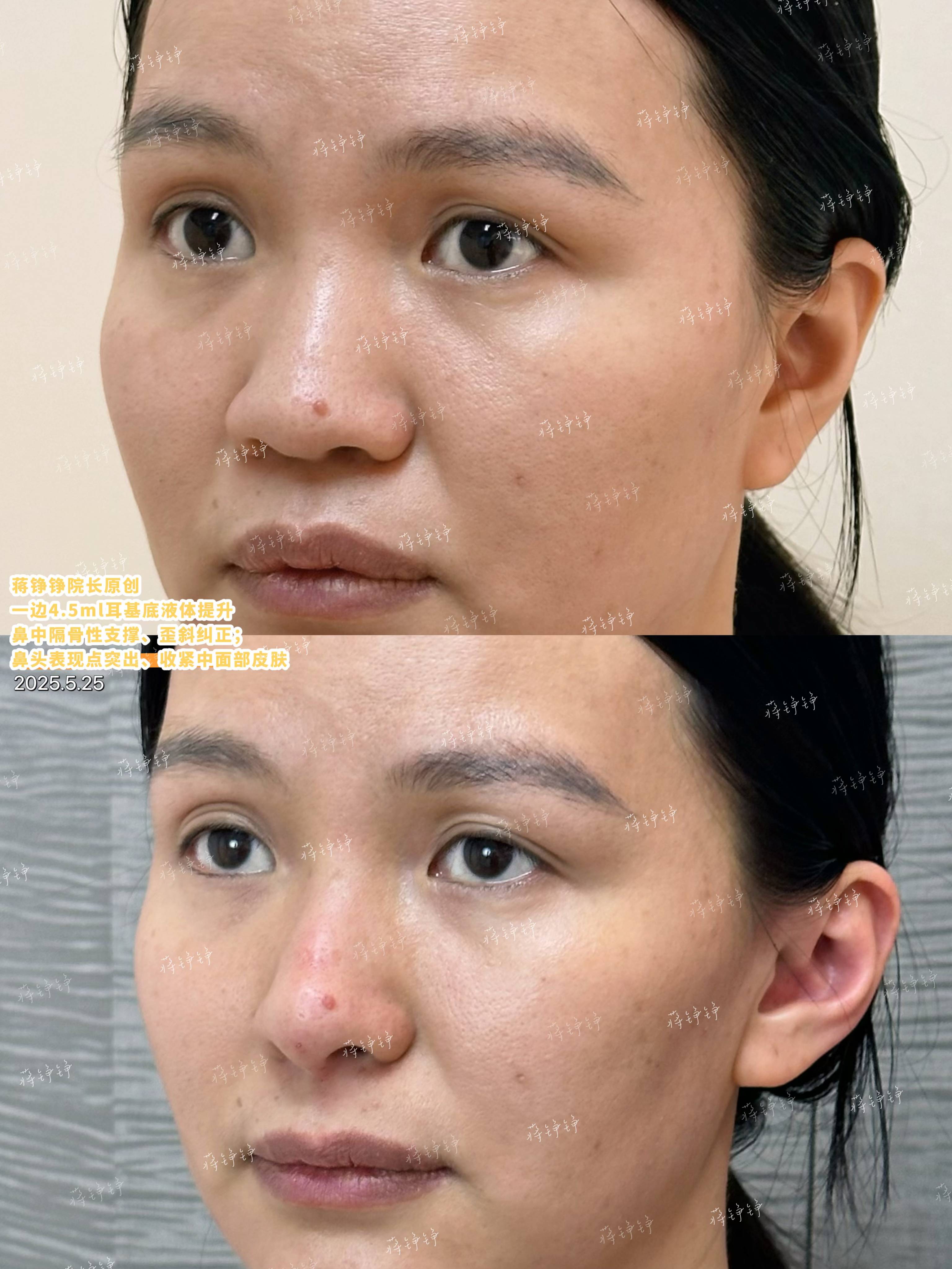 杭州愛(ài)爾眼科技術(shù)口碑與預(yù)約攻略大揭秘