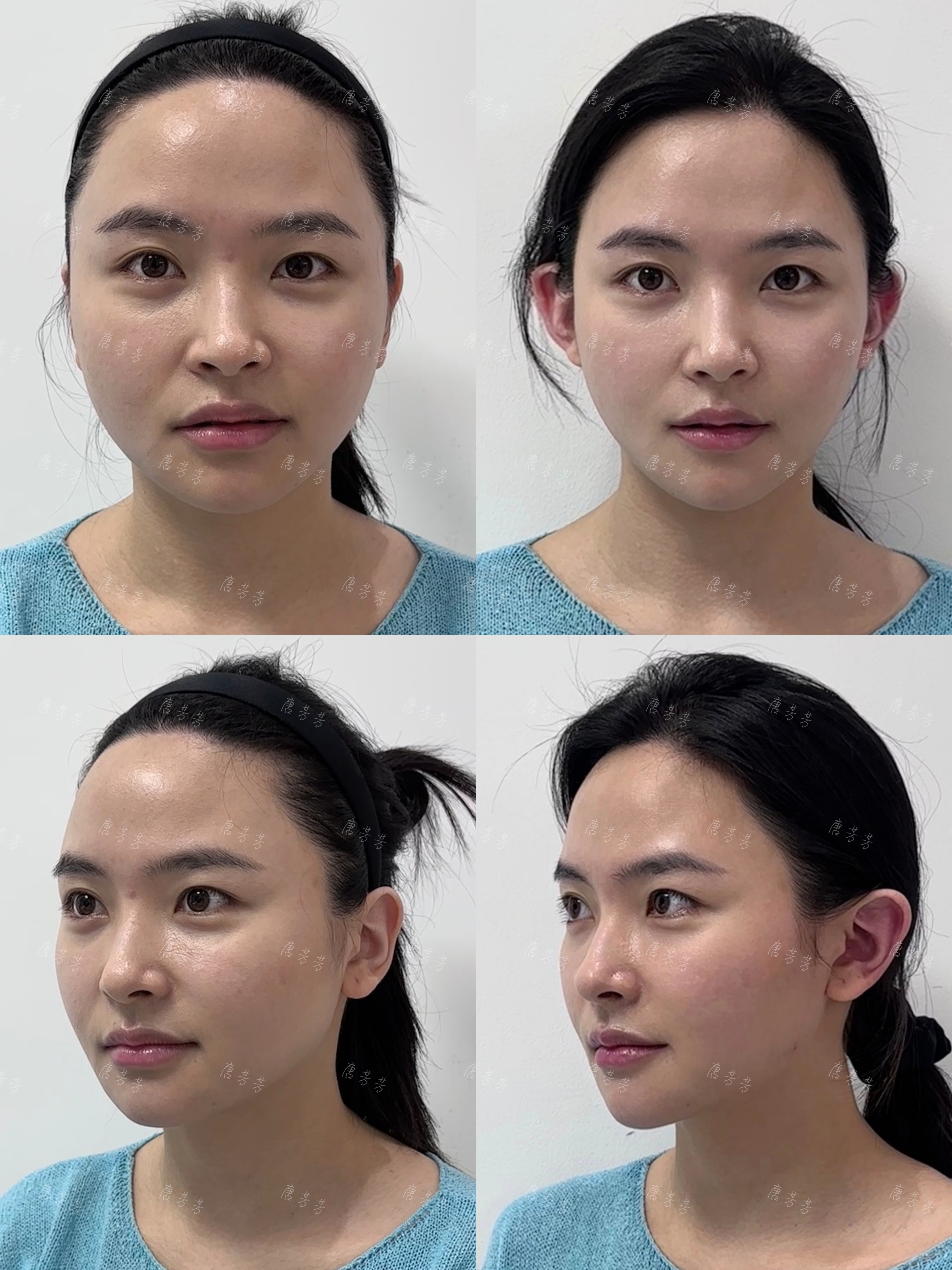 溫嶺愛(ài)爾眼科技術(shù)口碑與預(yù)約攻略大揭秘