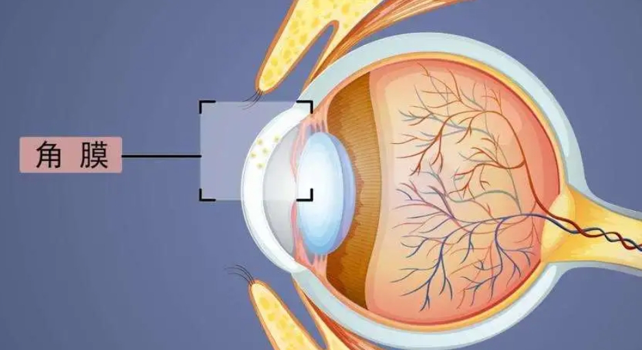 如何選擇適合自己的配鏡方案