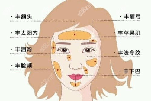 自體脂肪面部填充卡通圖