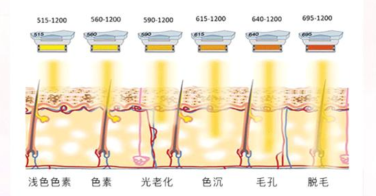 成功實(shí)例展示